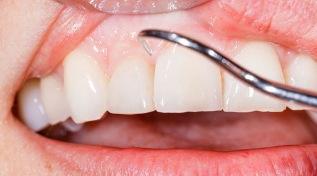 periodontoloji